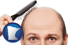 minnesota map icon and a balding man brushing his hair
