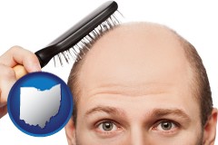 ohio a balding man brushing his hair