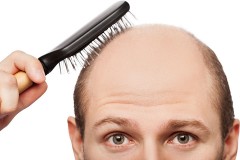 a balding man brushing his hair